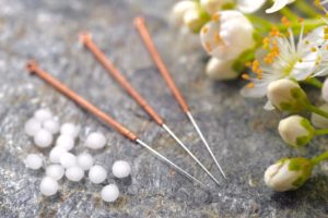 A close up of acupuncture needles and pills